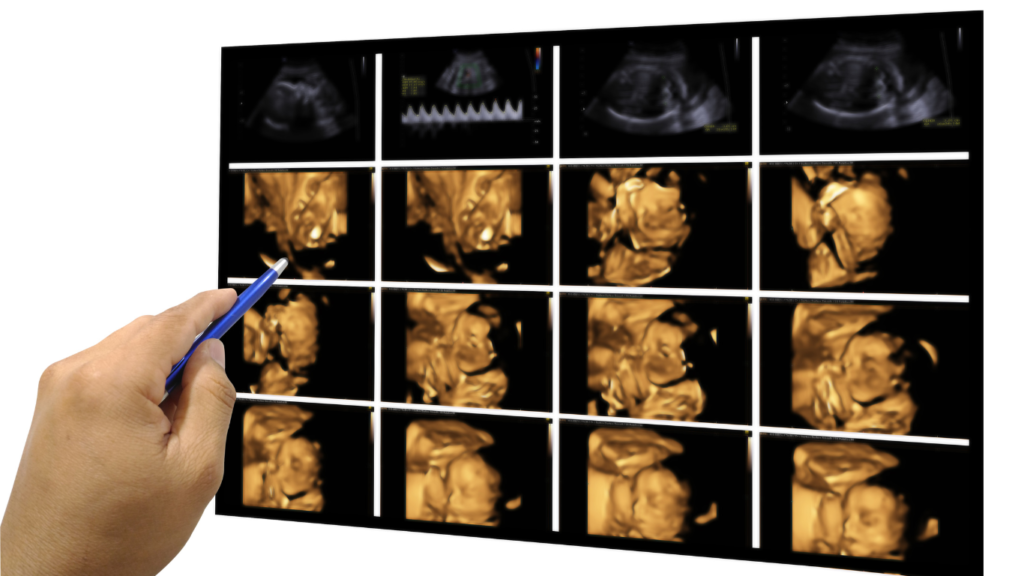 Perkhidmatan Ultrasound 4D - Sihat Itu Nikmat - Ada Sakit Jangan Simpan - Klinik Al-Fatih