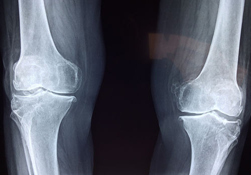 Perkhidmatan Xray - Sihat Itu Nikmat - Ada Sakit Jangan Simpan - Klinik Al-Fatih